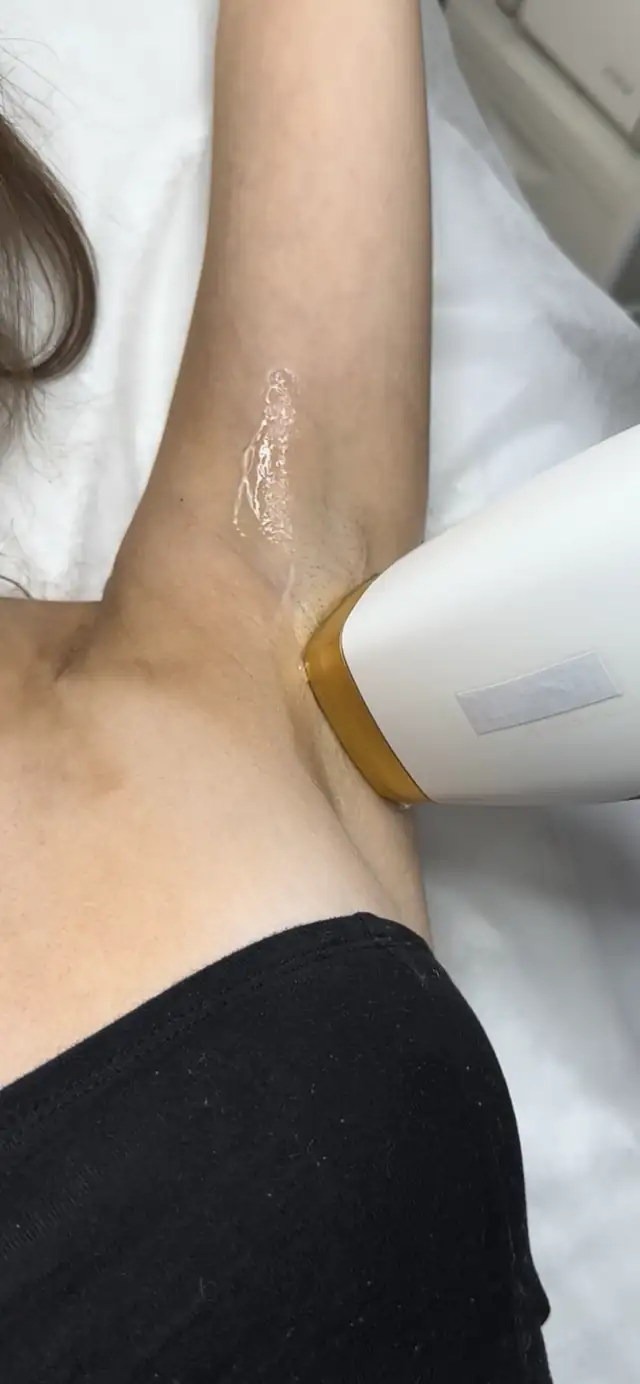 Depilacja laserowa w Quality House of Beauty