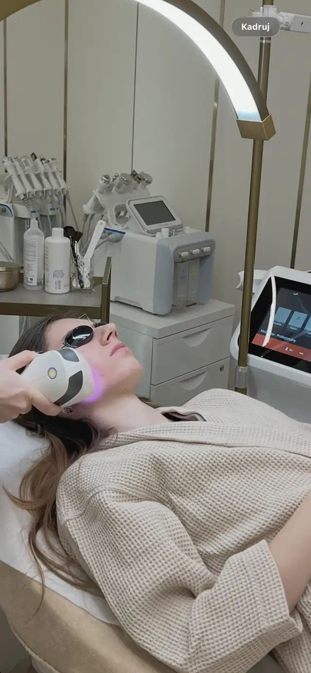 Laserowe leczenie trądziku Mediostar Monolith w Quality House of Beauty